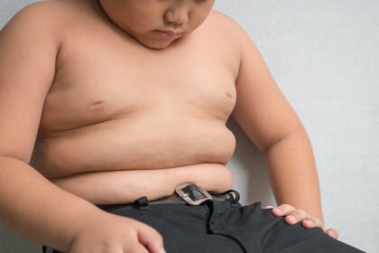 Children Obesity In India